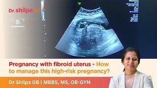 Pregnancy with fibroid uterus - How to manage this high-risk pregnancy | Dr Shilpa G B