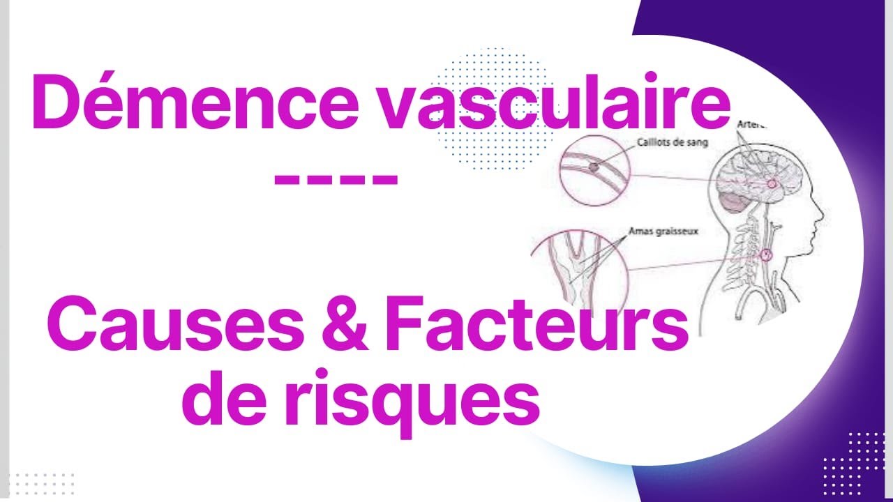 Démence vasculaire,causes et facteurs favorisants#santé#santépourtous #