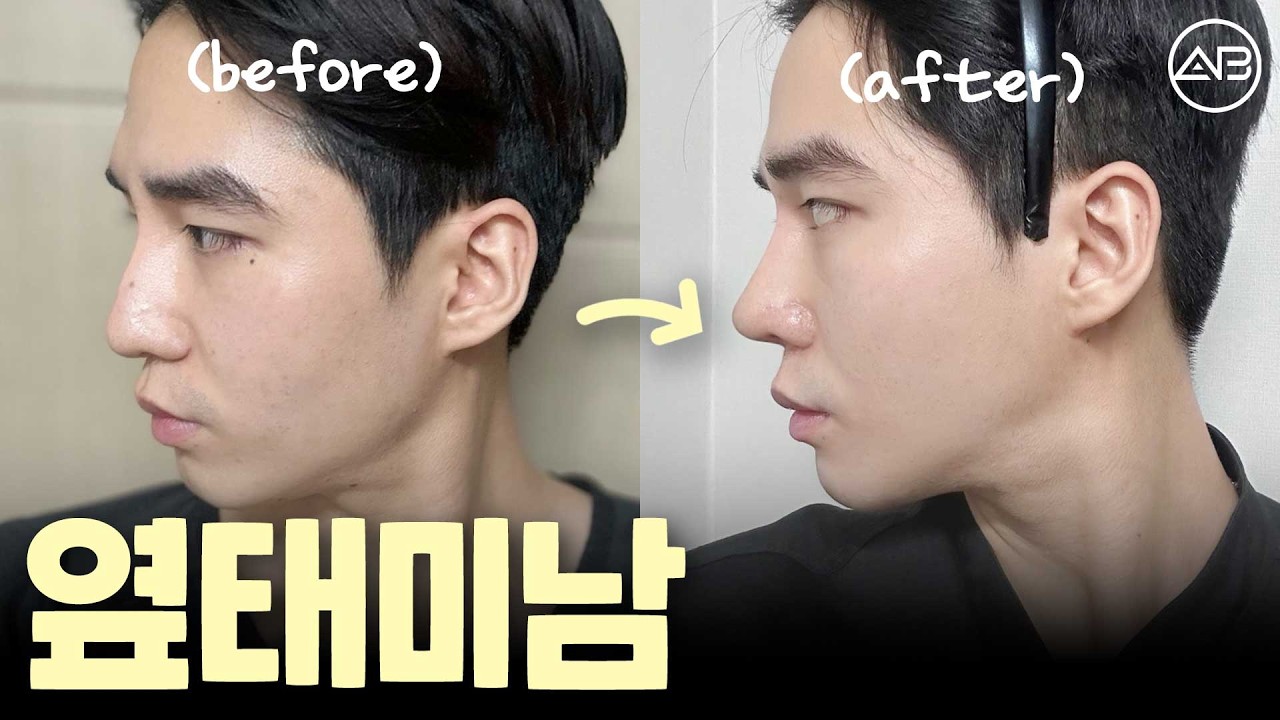 훈남의 정석 T존 확보👃남자 코성형&윤곽 수술로 얼굴 입체감 살리기 | 에이비성형외