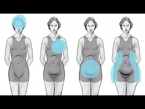 Video: Können Hormone zu Bandschwäche führen?