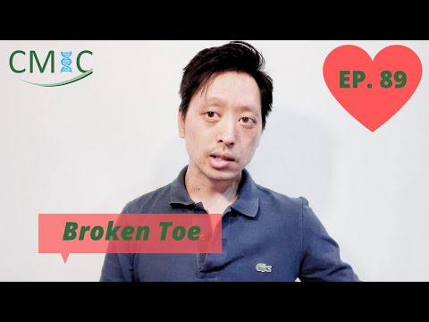 นิ้วเท้าหัก: (Broken Toe) โดยนายแพทย์จักรีวัชร