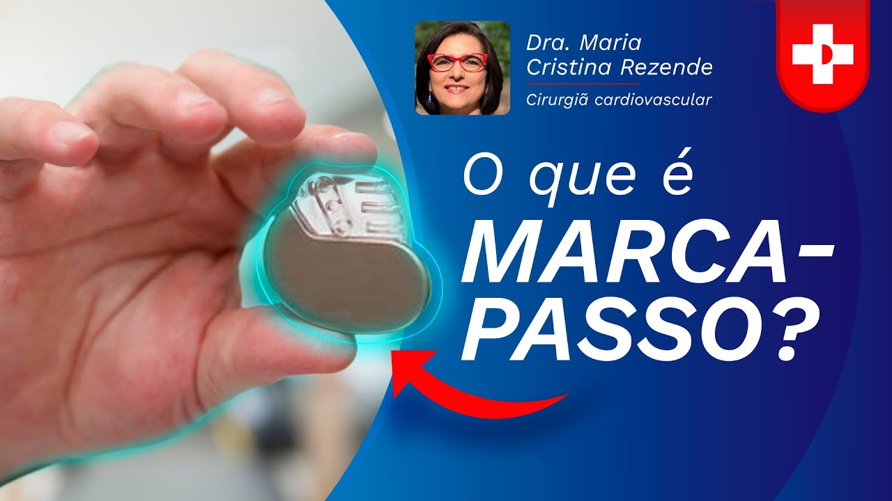 O que é marcapasso? YouTube O que é marcapasso? YouTube