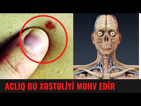 Video: Oruc Zamanı Balıq Yeyə Biləcəyiniz Zaman