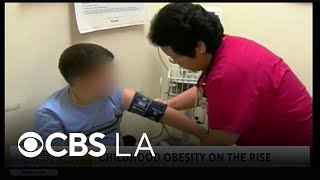 Doctor addresses the rising rate of childhood obesity