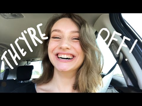 I GOT MY BRACES OFF!! // deep overbite, crowding, bite plate, rubber bands