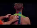KT Tape: Neck and Shoulder