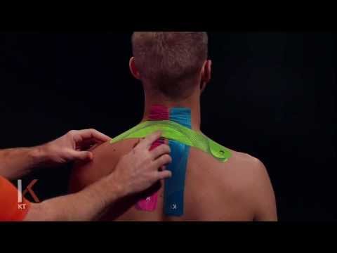 KT Tape: Neck and Shoulder