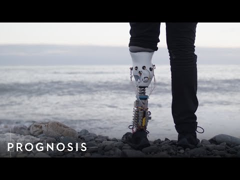 تصویری: خزنده های پوست: یک مهندس زیست مهندسی از روسیه ربات هایی را در MIT ایجاد کرده است که می توانند سرطان را پیدا کنند