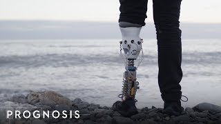 This MIT Engineer Built His Own Bionic Leg