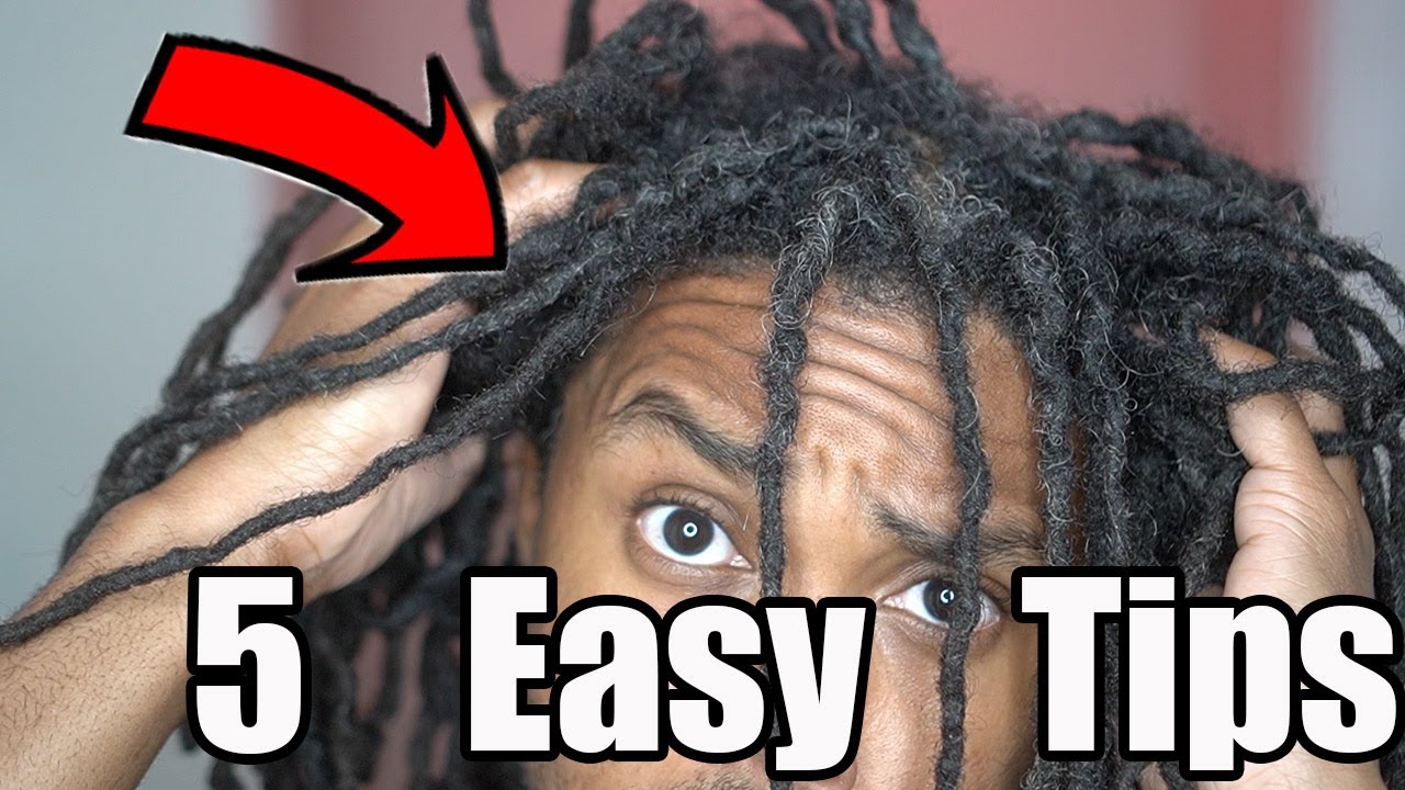 How to Fix Your Itchy Scalp with Dreadlocks YouTube