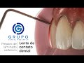 Passo a Passo do Preparo Dental de Laminado Cerâmico / Lente de contato dental (Como fazer?)