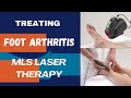 Treating foot arthritis with mls laser therapy