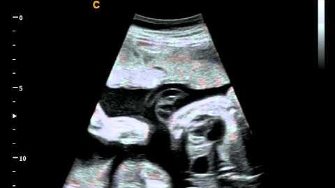 Q5Vet Fetal Heart Best color Doppler Ultrasound for veterinary application