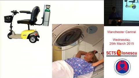 SABR in borderline lung function