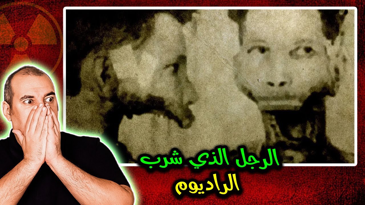 صور حقيقية ورائها 3 قصص واقعية نهايتها مأساوية  - الجزء 2 -  تحذير ⚠️ ( صور مزعجة ) #osha_salah #قصص