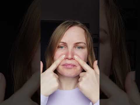 Video: Ako vyliečiť veľmi silnú bolesť hlavy (s obrázkami)