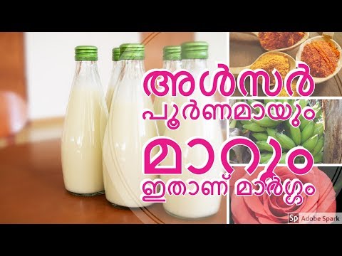 അൾസർ പൂർണ്ണമായും മാറ്റം | Ulcer home remedy| 21 days treatment plan