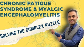 CHRONIC FATIGUE SYNDROME & ME Clinical Evaluation in Solving the CFS Puzzle  Dr Rege Explains