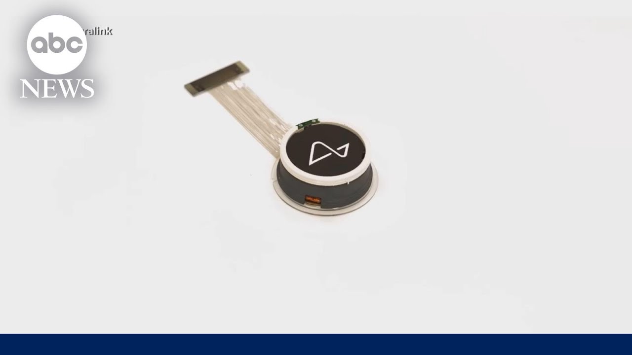 How Elon Musk’s Neuralink’s brain implant works