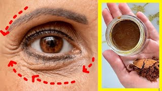 The Amazing Transformation of Under-Eye Wrinkles -Bye to Dark Circles with Homemade Coffee Eye Cream