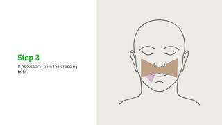 Download Lagu Mepilex Lite Application under oxygen mask MP3 Download Lagu Mepilex Lite Application under oxygen mask MP3