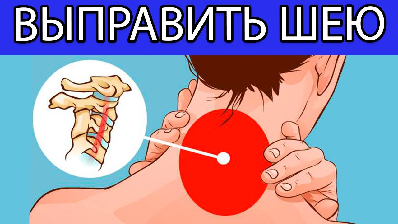 Упражнения, помогающие ослабить БОЛЬ и ВЫПРАВИТЬ ШЕЮ (шаг за шагом ...