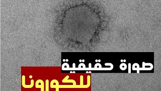 أول صور حقيقية لفيروس كورونا تحت المجهر- المايكروسكوب| Corona Under micro