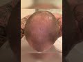 3-Monats-Special 😎🔥 Das ist der Daily Hair Growth Progress im dritten Monat ✨🪄🌱