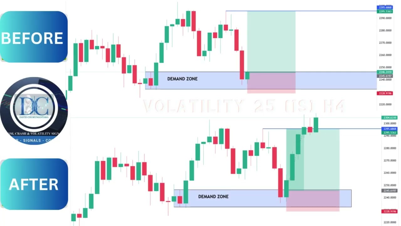 Volatility 25 (1s) Index Analysis & Live Trade Results | Precision Trading Insights 📊🚀