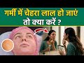 Garmi Me Chehra Lal Ho Jaye To Kya Kare: गर्मी में चेहरा लाल हो जाएं तो क्या करें |Home Remedy