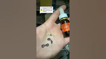 علاج الكساح و التواء القدمين و مشاكل العظام لطيور الزينه طيور عصافير ببغاوات Parrot Bird Pet 