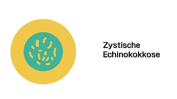 Welche Symptome verursacht die Echinokokkose?