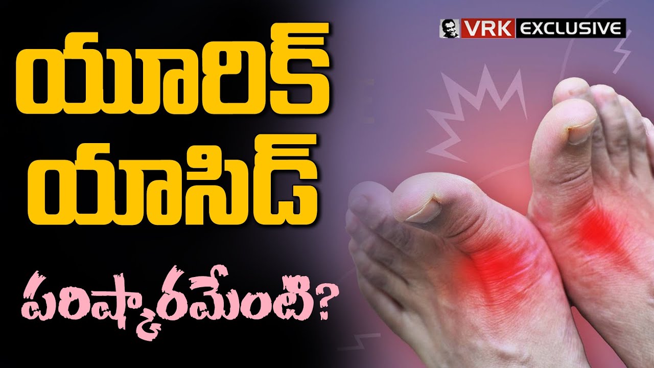 Uric Acid Symptoms | Uric Acid Treatment in Telugu | #health | VRK Diet | Veeramachaneni | #telugu