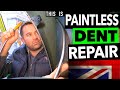 BAD DAMAGE ON A FRONT FENDER❗️🇬🇧 | Multiple Dents Fixed WITHOUT Painting | By Dent-Remover