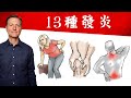 13種發炎,消炎自然療法,柏格醫生 Dr Berg