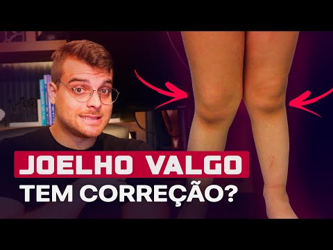 Vídeo: Por que meus joelhos não estão retos?