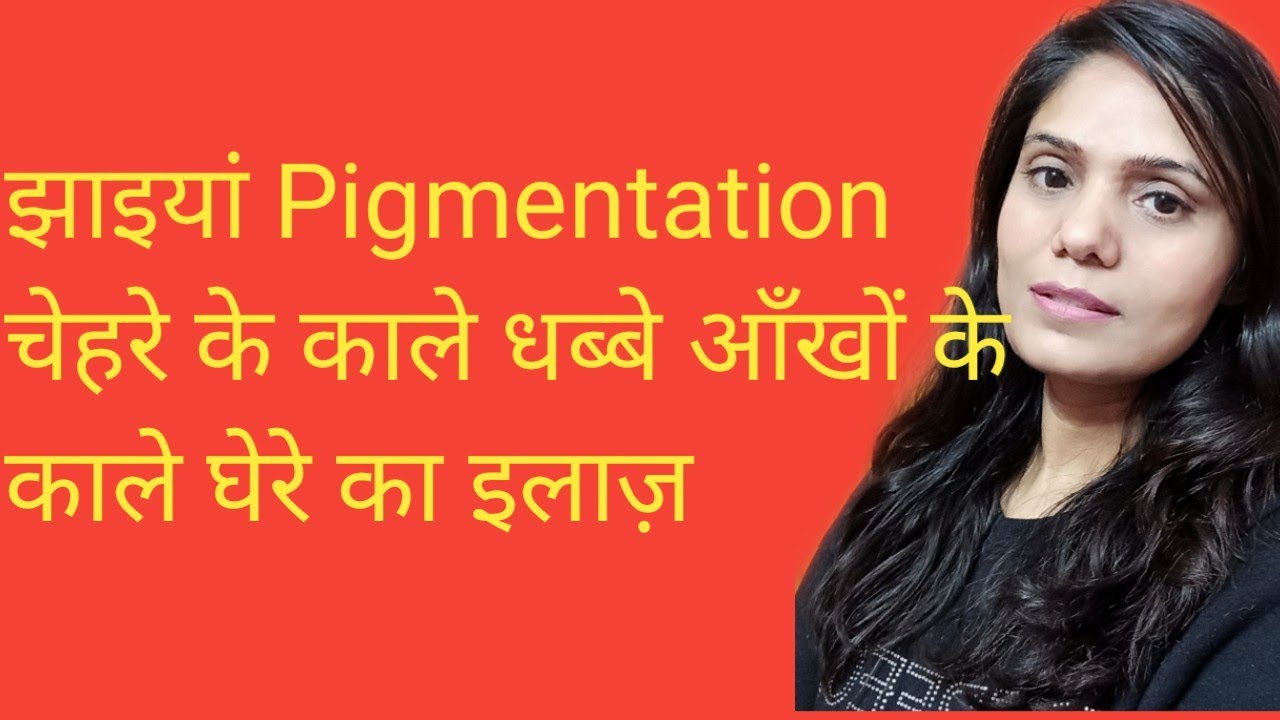 Jhaiya Khatam karne ka tarika. Pigmentation treatment on face. Chehre