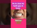 how to close my front teeth gap with rubber band|| front teeth gap closing || home ideas || dont try