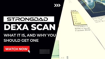 The Gold Standard In Body Composition Measurement - The DEXA Scan