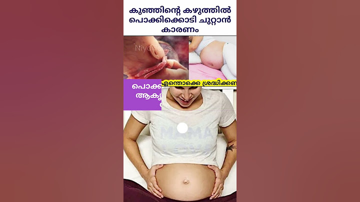 കുഞ്ഞിന്റെ കഴുത്തിൽ പൊക്കിൾക്കൊടി ചുറ്റുന്നത് എങ്ങനെ  💯#shorts #youtubeviral #trending #livevideo