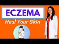 Eczema  dr rajsrees natural protocol for healing your skin