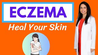 ECZEMA:  Dr. Rajsree's Natural Protocol for Healing Your Skin! by Rajsree Nambudripad, MD 57,793 views 7 months ago 22 minutes