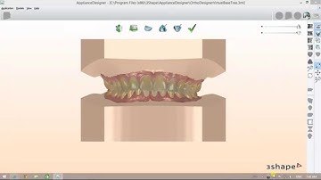 How to Prepare Orthodontic Models Set (Virtual Models Bases)