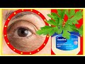 USE Parsley CREAM AND Parsley SERUM FOR 7 DAYS, Remove  Eye Bags + Dark CIRCLES + Eye WRINKLES