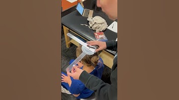 Cervical rotation ROM