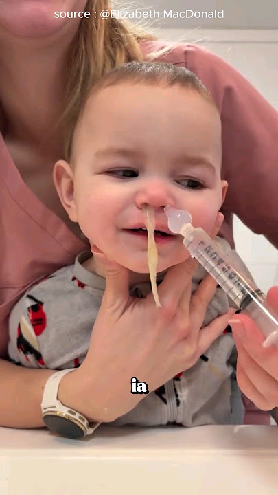 Anak Ini Mengeluarkan Semuanya Dari Hidungnya ‼️