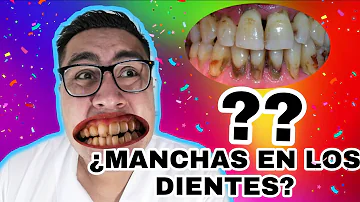 ¿Por qué se vuelven marrones los dientes delanteros?