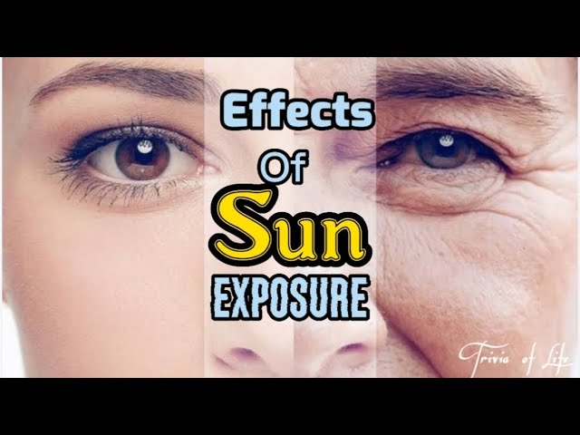 Effects of Sun Exposure | Epekto ng Araw sa Tao