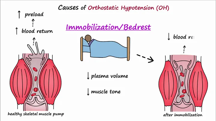 Orthostatic Hypotension (Described Concisely) - DayDayNews