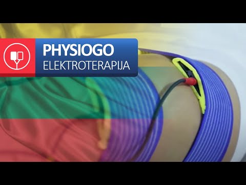 Video: Ar elektroterapija kada nors veikė?